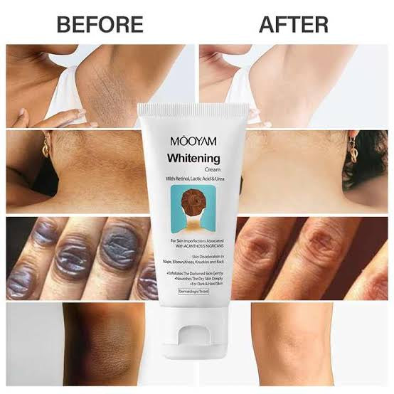 Mooyam whitening cream