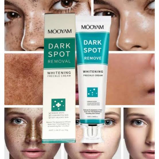 MOOYAM Dark Spots Remover Whitening
Freckle Cream - 30g