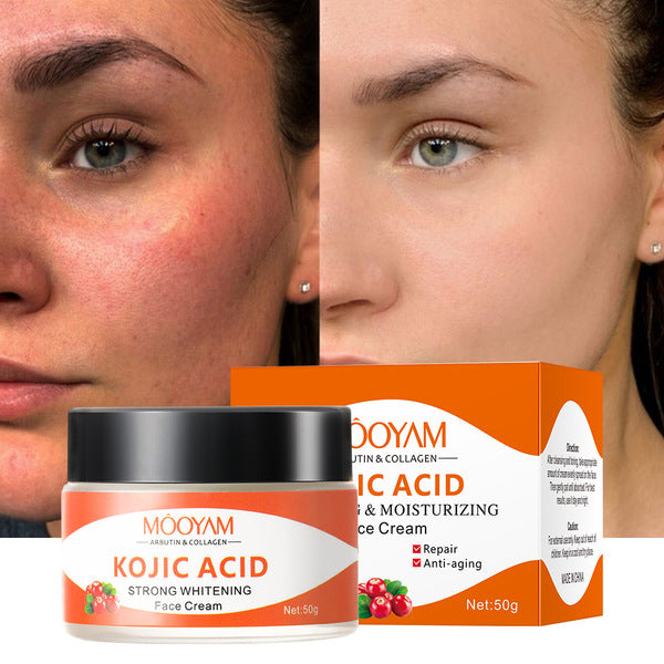 Kojic Acid Face cream Anti Aging Wrinkle Acne Dark Spot Removing Whitening Face Cream