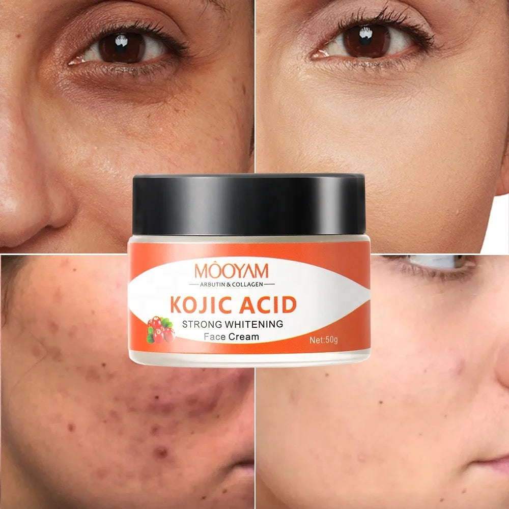 Kojic Acid Face cream Anti Aging Wrinkle Acne Dark Spot Removing Whitening Face Cream